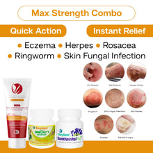 Load image into Gallery viewer, Max Strength Eczema/Psoriasis Combo Pack of 2
